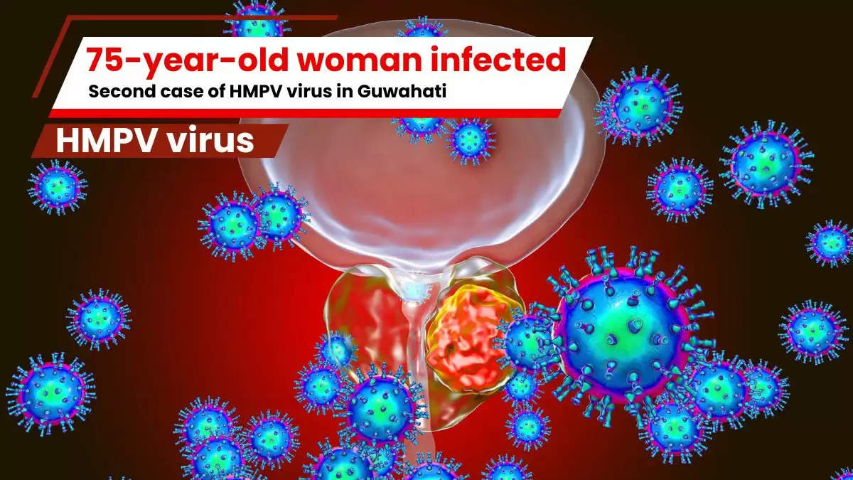 Second case of HMPV virus in Guwahati, 75-year-old woman infected